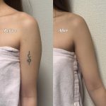 滋賀県からタトゥーカバーのお客様 滋賀県からタトゥーカバーのお客様