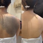 生まれつきの蒙古斑をエアブラシでボディメイク 生まれつきの蒙古斑をエアブラシでボディメイク