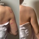 ボディーメイクとタトゥーカバー ボディーメイクとタトゥーカバー