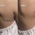 ナイトウェディングの花嫁様へタトゥーカバー